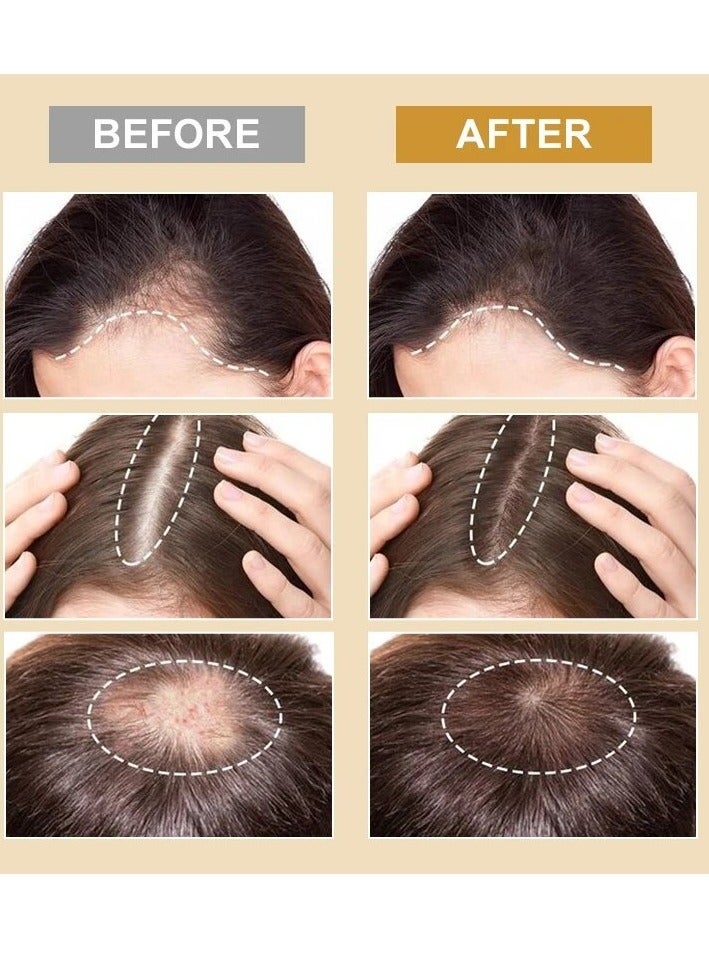 PURC بخاخ مضاد لتساقط الشعر ونمو الشعر علاج ترقق الشعر تقليل تساقط الشعر تكثيف الشعر وتطويله معطر للشعر إزالة الروائح الكريهة 50000 جزء في المليون بخاخ نمو الشعر بالبيوتين والكولاجين مصل نمو الشعر 30 مل - Image 5