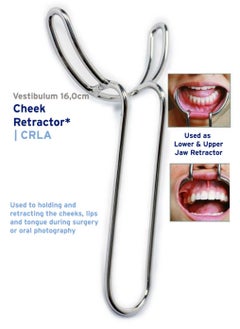 Crosstex Dental Instrument Vestibulum Cheek Retractor 16,0cm 