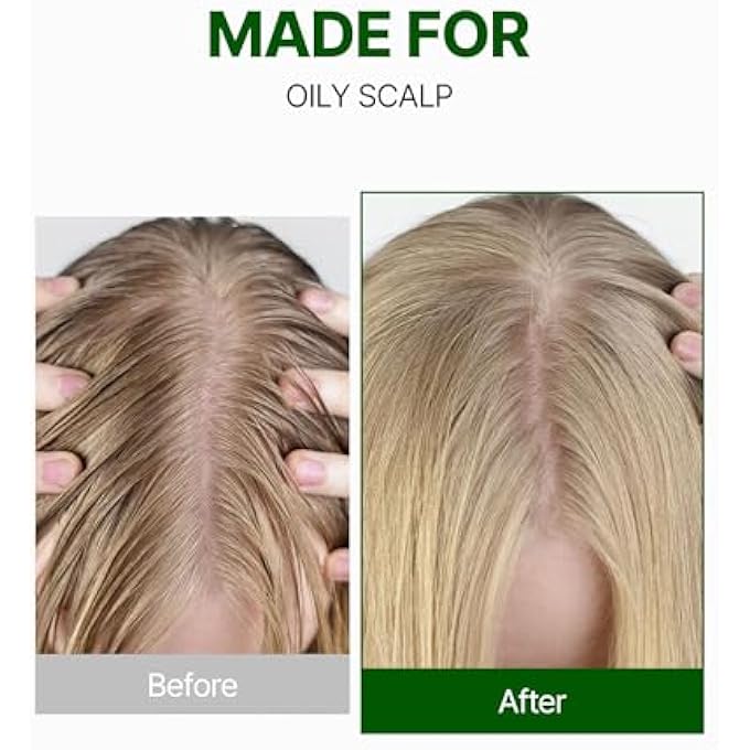 KUNDAL TEA TREE & MACADAMIA DEEP CLEANSING SHAMPOO - KOREAN HAIR CARE, SCALP CARE, TEA TREE EXTRACT, FOR ALL HAIR TYPES 10.14FL OZ EACH (PACK OF 2) (BABY POWDER) - Image 3