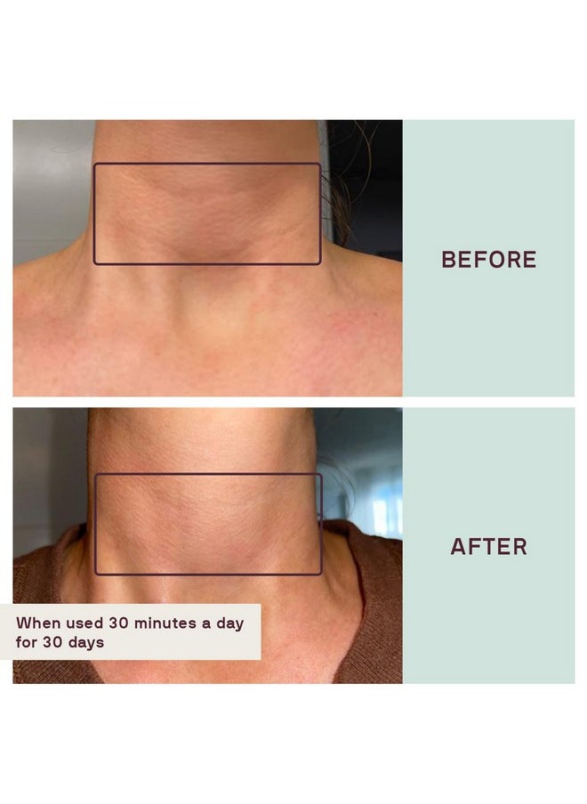 Dermaclara Neck Wrinkle Patch Silicone Fusion Treatment Neck Patches For Wrinkles & Fine Lines Antiwrinkle Patches For Pregnancy Safe Skincare Reusable Up To 30 Times  - Image 5