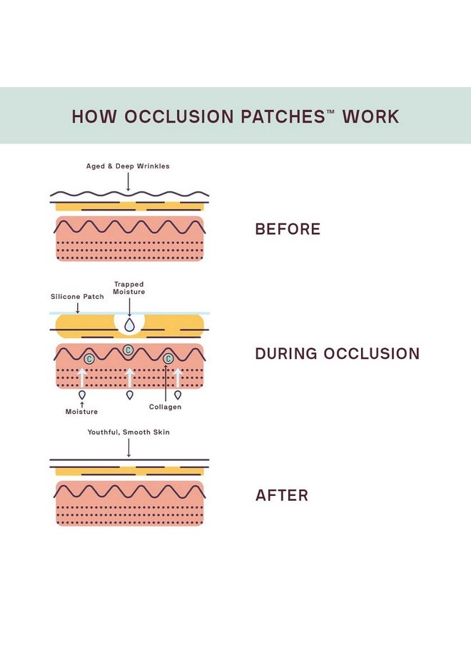 Dermaclara Neck Wrinkle Patch Silicone Fusion Treatment Neck Patches For Wrinkles & Fine Lines Antiwrinkle Patches For Pregnancy Safe Skincare Reusable Up To 30 Times  - Image 4