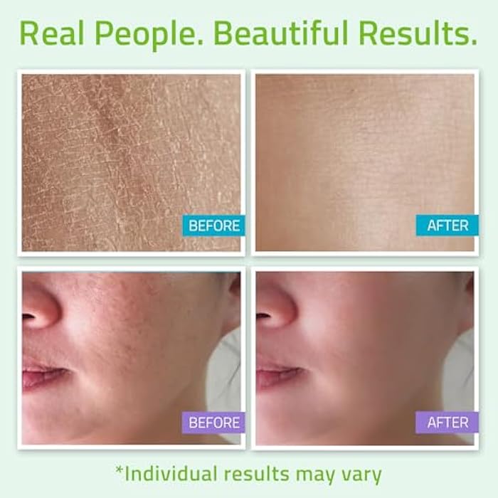 YEOUTH Skin Care Set: Hyaluronic Acid Serum, Vitamin C Cleanser, Toner & Face Cream, Teen Skincare Kit Girls & Boys 4-Piece Beauty Gifts - Image 5