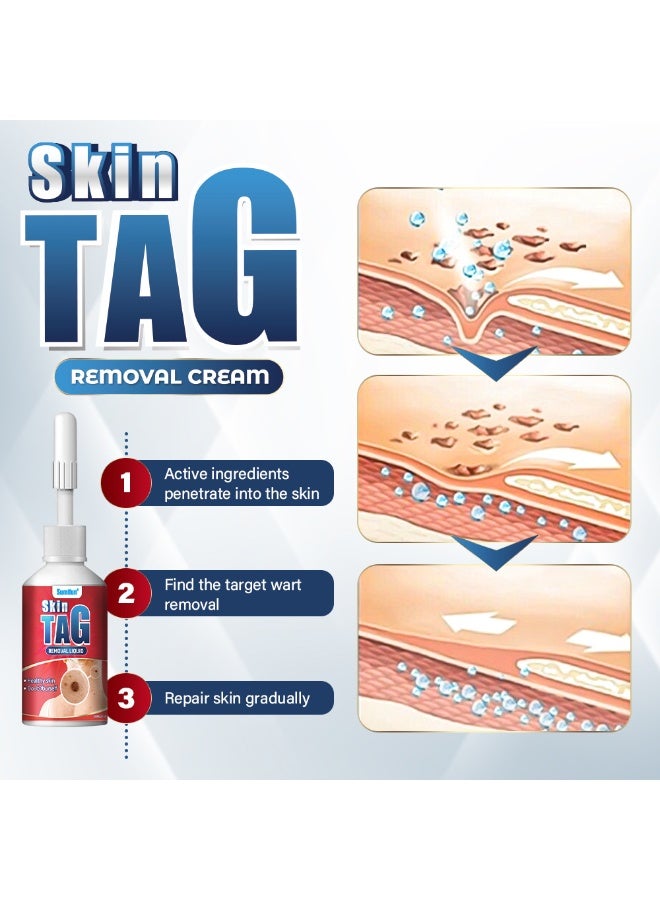 سوميفون محلول العناية الصحية الخارجية للثآليل Sumifun - Image 5