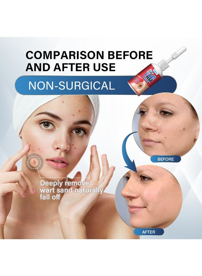 سوميفون محلول العناية الصحية الخارجية للثآليل Sumifun - Image 4