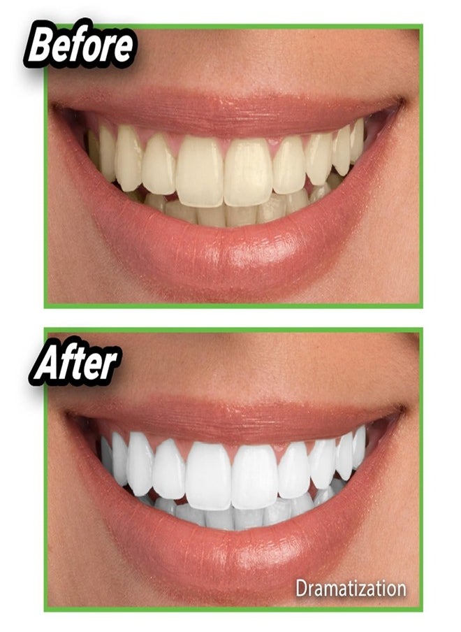 Generic - Teeth Whitener - Natural Whitening Coconut Charcoal Powder - Image 1