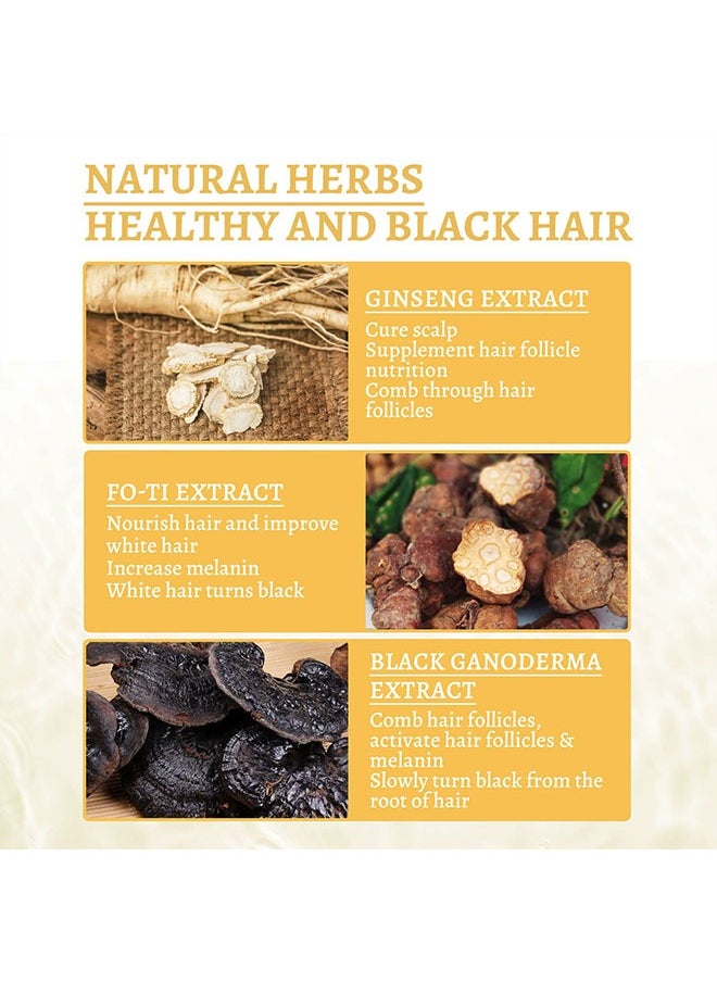 SOUTH MOON - Ganoderma Nutrient Essence,Has The Effect Of Supplementing Hair Follicles, Repairing Hair Damage, Activating Hair Follicles And Melanin, And Obtaining Shiny Black Hair 30ml - Image 1