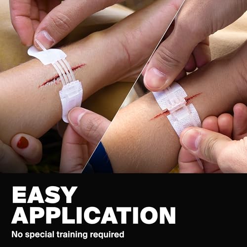 SurviveX Zip Stitch Wound Closure Strips Kit - Repair Wounds Without Stitches - Zipstitch Sutures - Laceration Closure Kit - Image 4