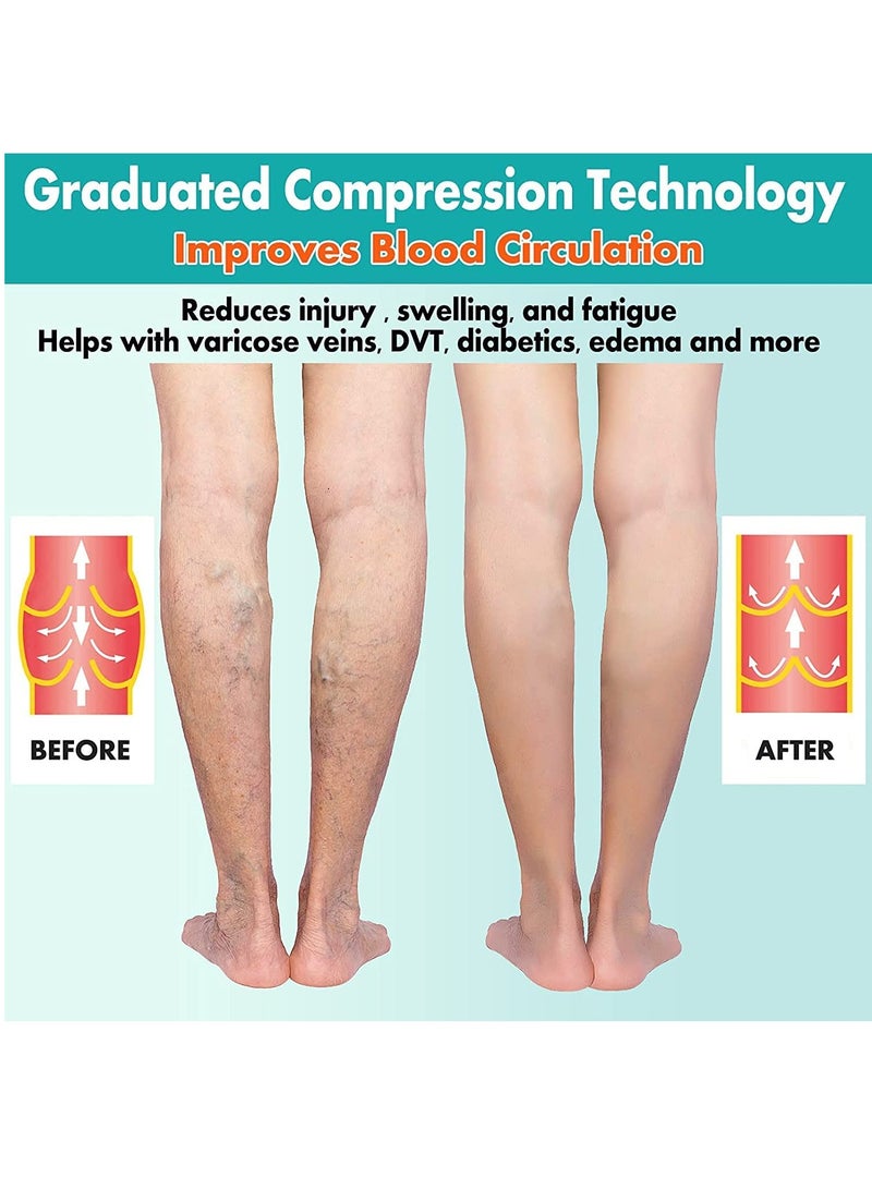 2 Pairs Compression Socks Open Toe Compression Stockings Knee High Socks with Zipper Compression Pantyhose 15-20mmHg for Improves Blood Circulation Prevents Leg Swelling (Beige Black) - Image 3