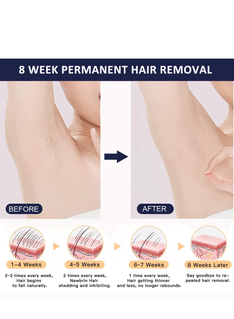 ملاي جهاز T14 IPL لإزالة الشعر بالضغط مع عدسة بيكيني - Image 5