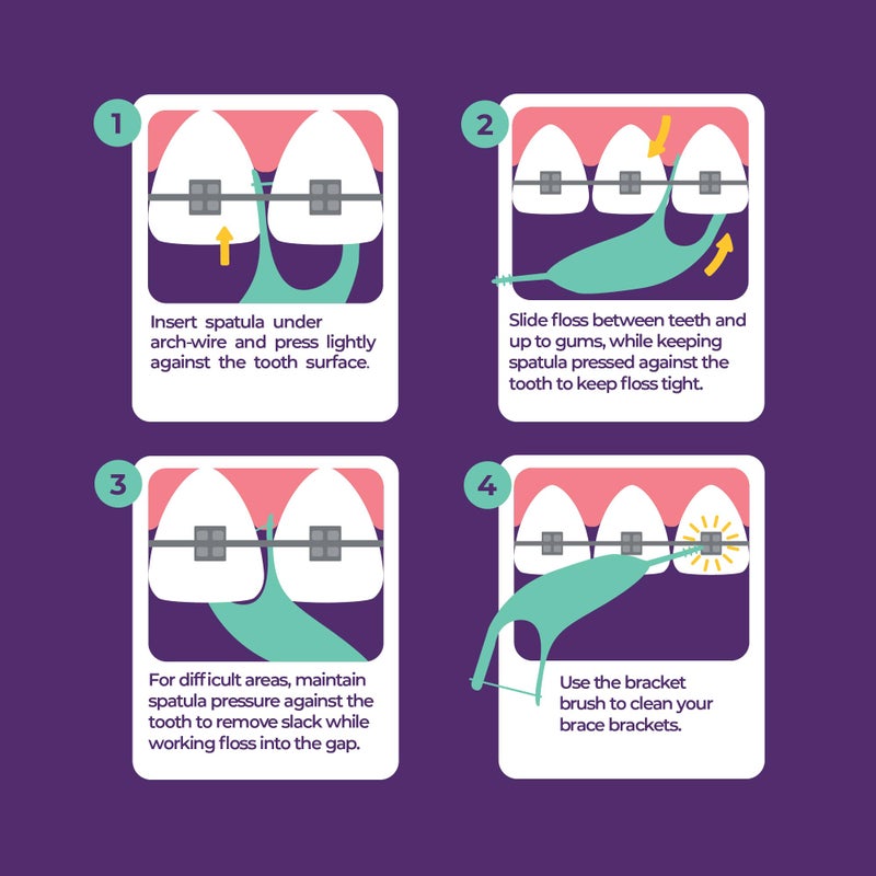 Platypus Orthodontic Flossers for Braces, 40 Count (Pack of 2), Ortho Picks for Adults & Kids, Fits Under Arch Wire, Non-Damaging, Encourage Flossing Habits - Image 3
