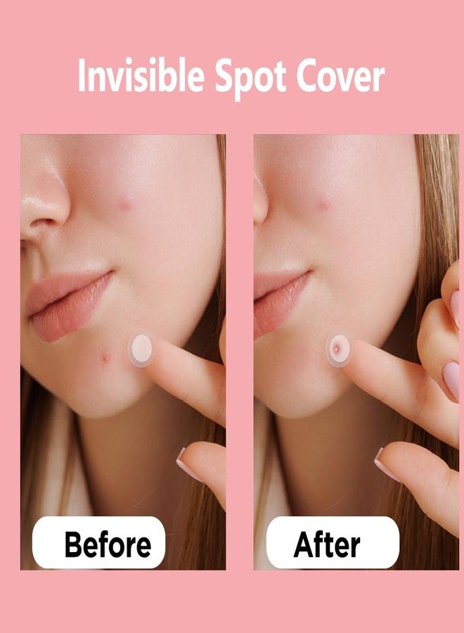 Floren Wonder Pimple Patch | Invisible Daytime Acne spot cover | Hydrocolloid Patch | For Zits, Blemishes, & Breakouts | Facial South Korean skin care | Drug-free, Gentle & Cruelty free | (90 dots ( Pack Of 1)) - Image 5