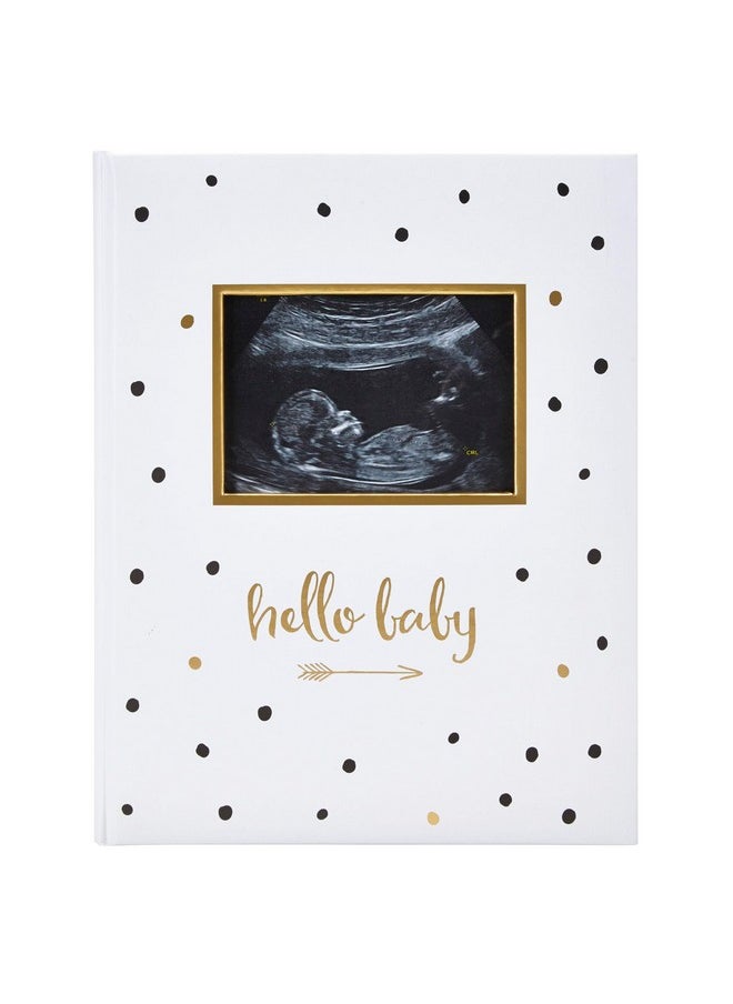 pearhead Hello Baby First 5 Years Memory Book, Gender-Neutral Baby Keepsake For New And Expectant Parents, Pregnancy And Milestone Journal, Modern Minimalist Black And Gold Polka Dot  - Image 1