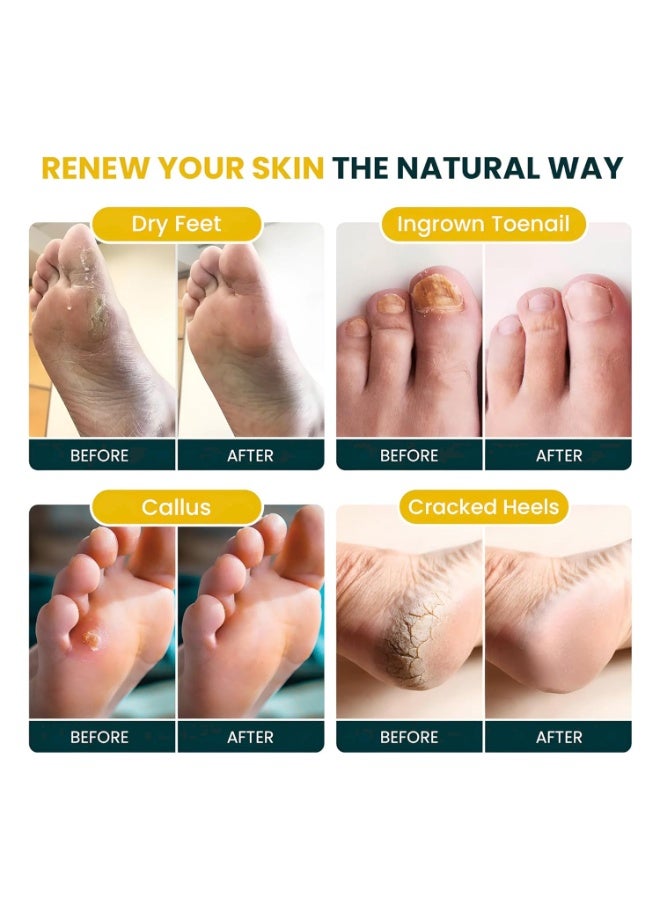 Foot Cure Citrus Detox Foot Soak with Epsom Salts – for Foot Callus, Da​​​​maged Toenail Appearance, Pedicure Spa, and Soothing Sore, Tired Feet – Made in USA – 16oz - Image 5