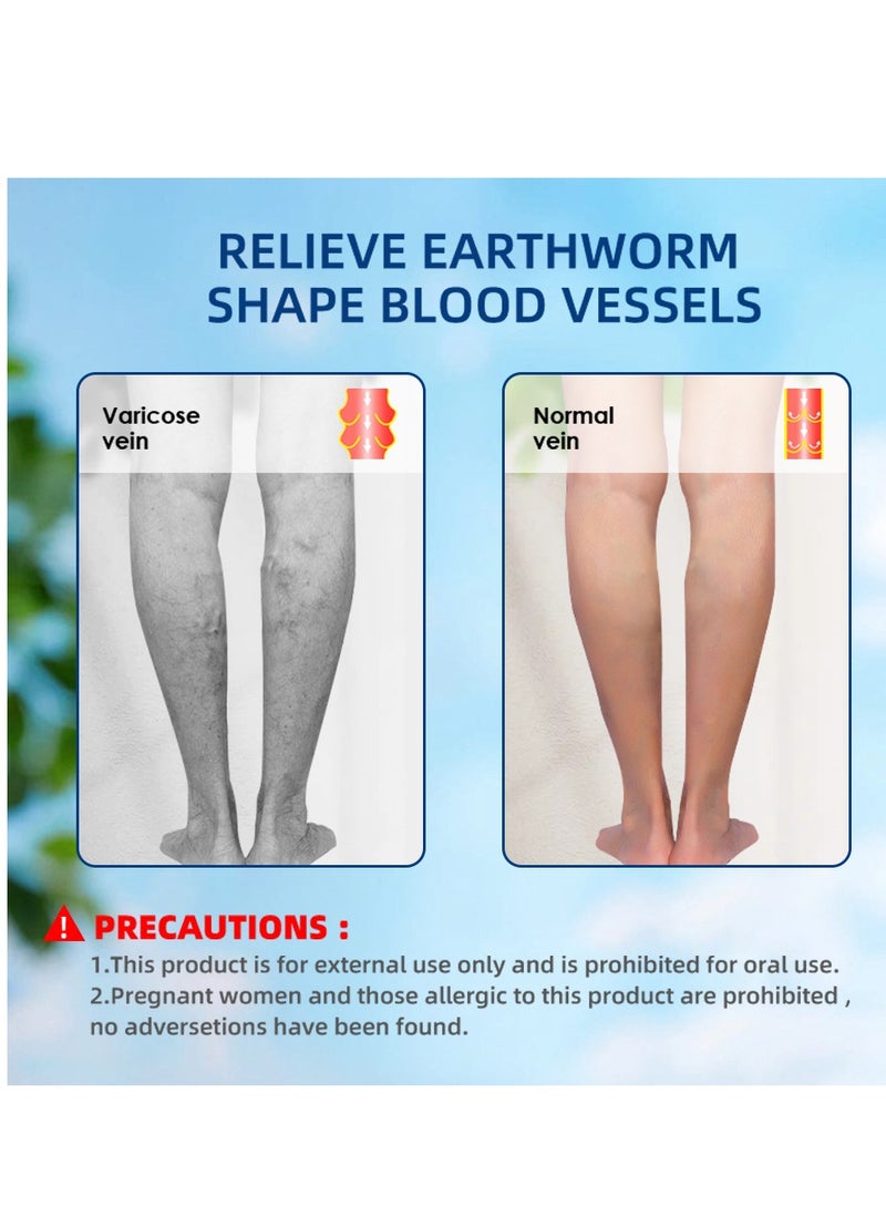سوميفون مرهم فعال لتخفيف الدوالي الوريدية لعلاج الدوالي لتخفيف التهاب الأوعية الدموية والتهاب الوريد وعلاج آلام العنكبوت - Image 3