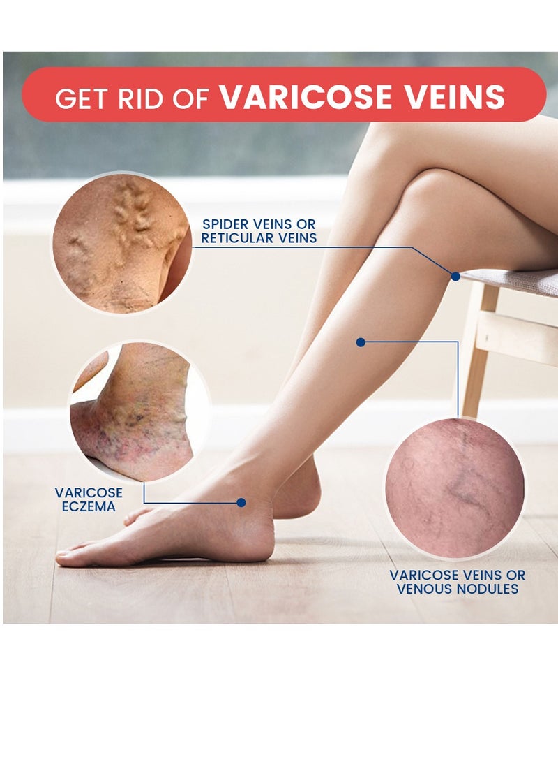 سوميفون مرهم فعال لتخفيف الدوالي الوريدية لعلاج الدوالي لتخفيف التهاب الأوعية الدموية والتهاب الوريد وعلاج آلام العنكبوت - Image 5