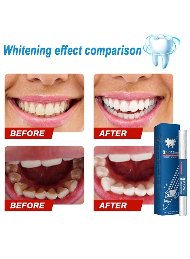 Teeth Whitening Pen,2 Pens,Tooth Whitening Pen for Bright White Teeth, Teeth Whitening Gel for Oral Care, Fast Removes Years of Stains, No Sensitivity, Effective and Painless Teeth Whitener - Image 3