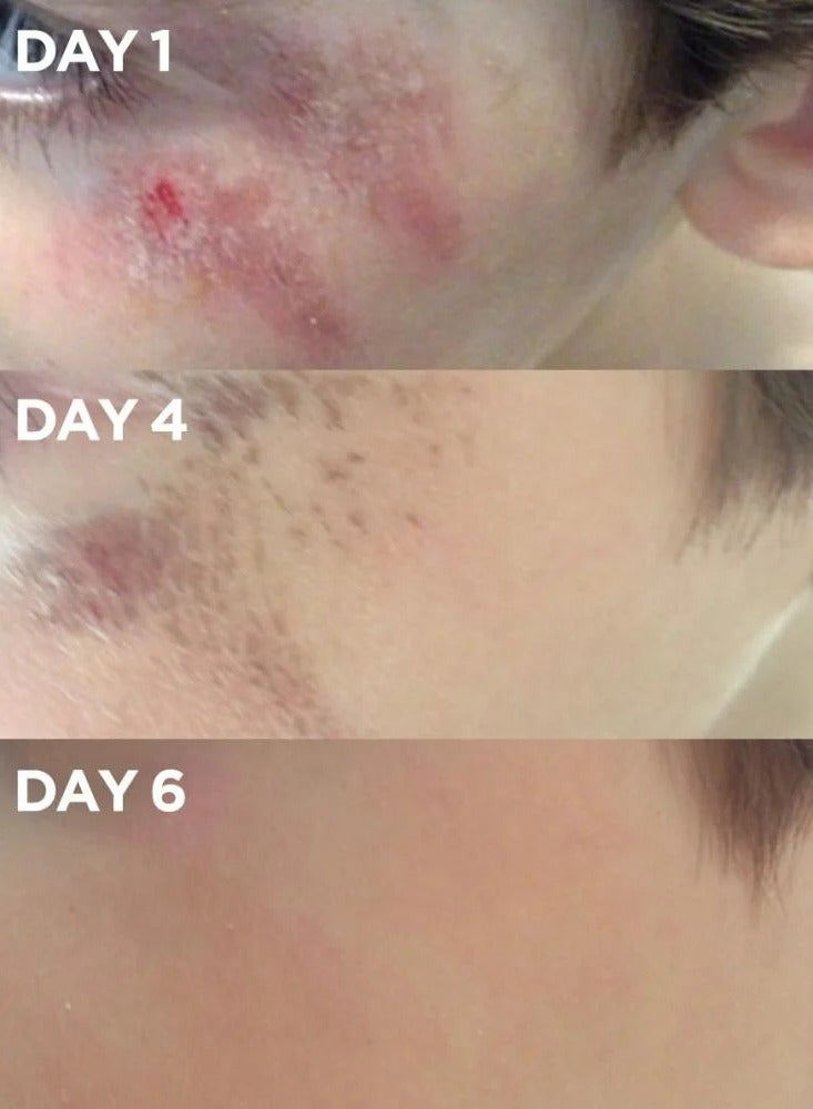 LANOLIN Lano Lin – Golden Dry Skin Miracle Balm (25g) - Image 3