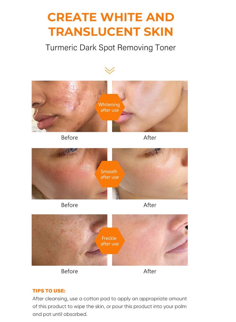 Tumeric toner  dark spots eraser very effective/Tumeric  dark spot removing toner /Moisturizing, hydrating and firming100ml - Image 5