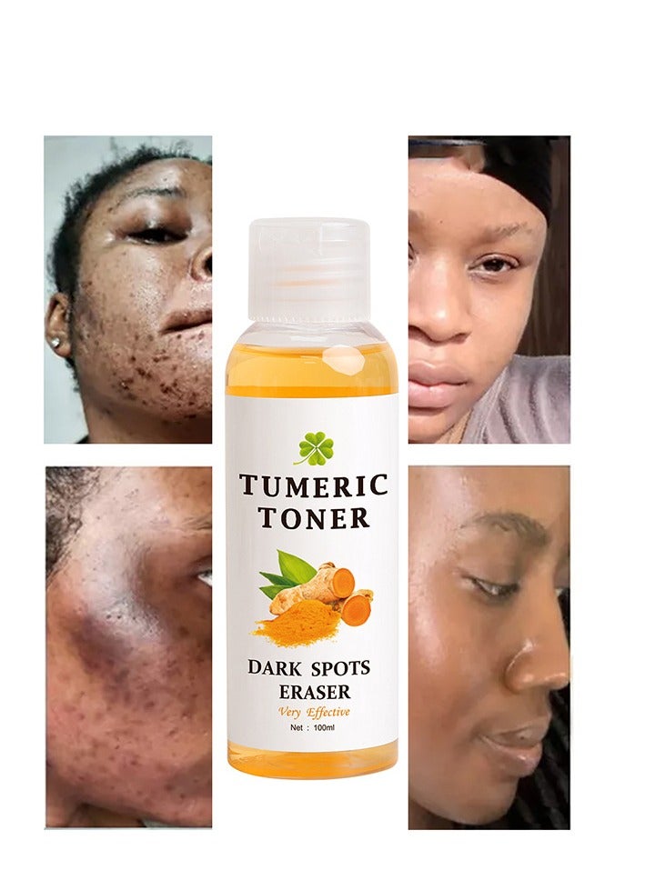 Tumeric toner  dark spots eraser very effective/Tumeric  dark spot removing toner /Moisturizing, hydrating and firming100ml - Image 3