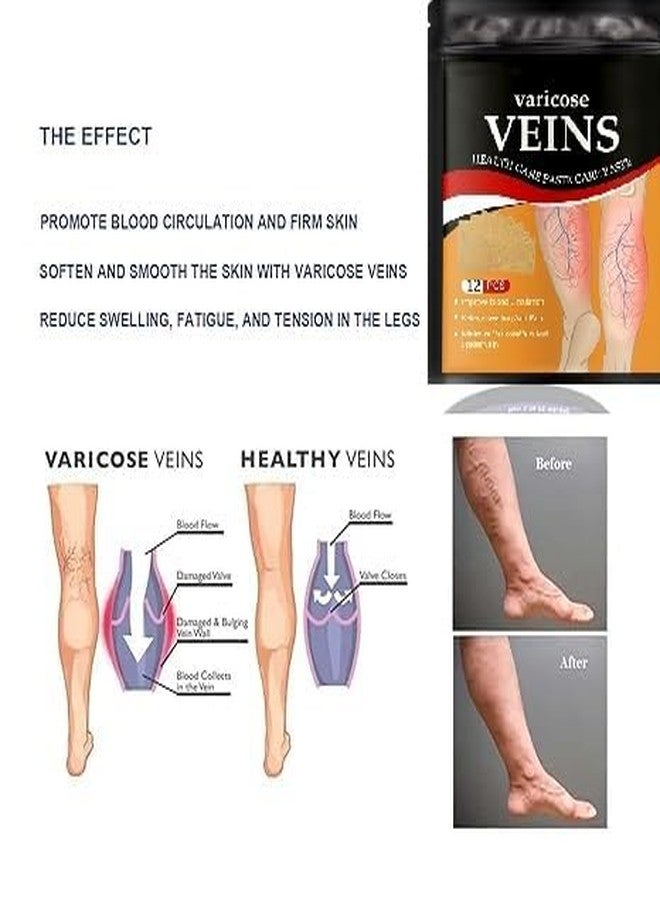 INNPOLE Varicose Veins Remover For Legs Patch Spider Veins Removal for Legs Patch,Improve Blood Circulation, Soothing Leg Fatigue (12) - Image 4