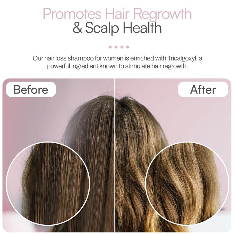 Foltene Strengthening Shampoo for Women â€“ Reduces Thinning, Boosts Volume, and Enhances Hair Health â€“ Silicone & Sulfate-Free Hair Thickening Shampoo for Fuller Strands (6.76 fl. oz.) - Image 4