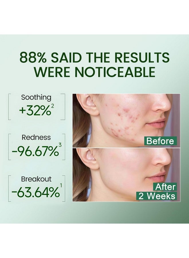 Alra Olive Therapy Serum for Face, Acne Treatment for Face with 22% Olive Extracts, Face Serum Reduces Redness & Acne, Rapidly Clear Breakout for Teens Adults, fit Oily & Acne-Prone Skin, 0.5 oz/15ml - Image 4