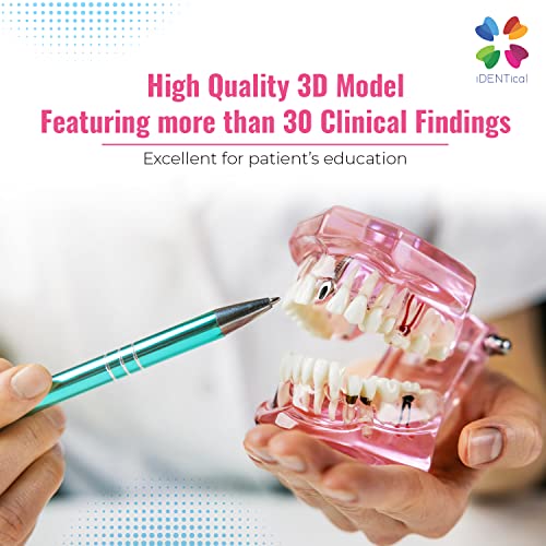 iDENTical All-In-One Implant Model M2001 – Pink | Comprehensive 3D Dental Training Model for Implantology & Restoration | Ideal for Patient Education, Study, and Professional Demonstration - Image 4