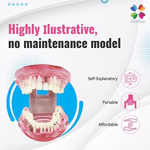 iDENTical All-In-One Implant Model M2001 – Pink | Comprehensive 3D Dental Training Model for Implantology & Restoration | Ideal for Patient Education, Study, and Professional Demonstration - Image 5