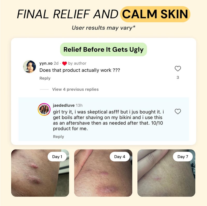 MyMagicHealer Universal Flare Care â€“ Multi-Purpose Solution | Skin Flare-Ups - Hidradenitis Suppurativa, Folliculitis, Boils, Cysts | Anti-Chafing | Irritated Skin Relief w/Propolis & Egg Yolk 4 oz - Image 4