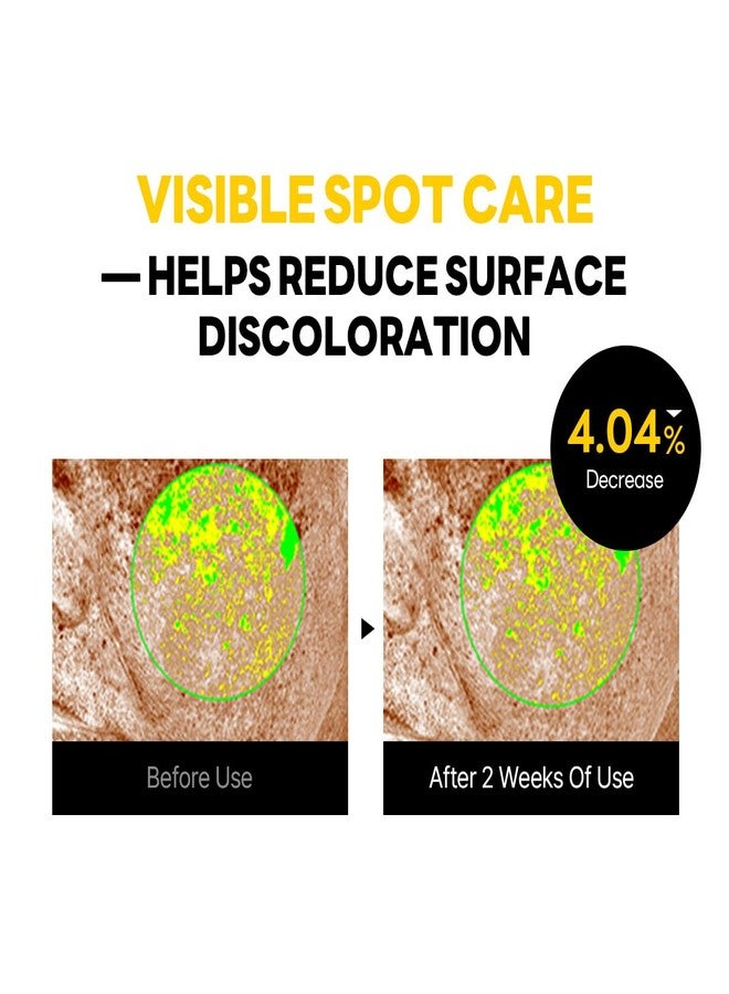 ROUND LAB كريم ROUND LAB فيتا نياسيناميد للبقع الداكنة 1.69 أونصة سائلة، مرطب توضيحي مع حمض الترانكساميك، ومجمع الفيتامينات للعناية بالبقع الداكنة، وملمس البشرة غير المتساوي، وإشراقة البشرة، العناية بالبشرة الكورية - Image 5