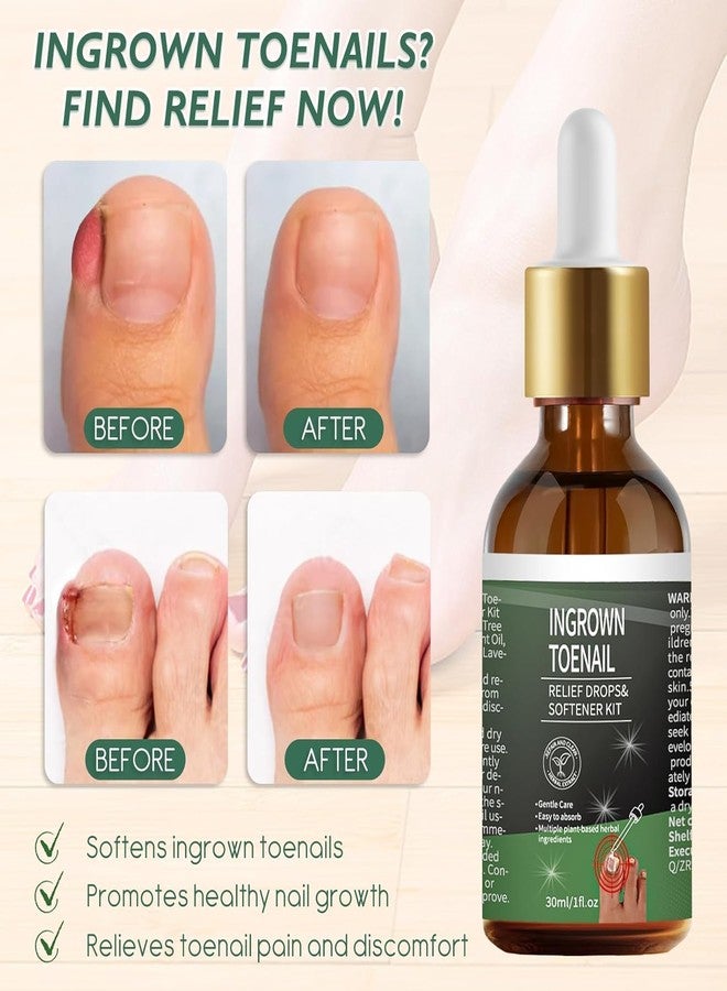 NWAKRD Ingrown Toenail Treatment - 30ml Softening & Conditioning Kit for Easy Trimming with Silicone Gel Toe Caps - Comprehensive Ingrown Toenail Removal Sol - Image 3