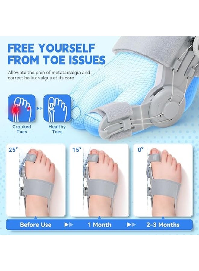 Toe Separator – Adjustable 360° Bunion Corrector – Relieves Big Toe Pain & Improves Foot Alignment - Image 4