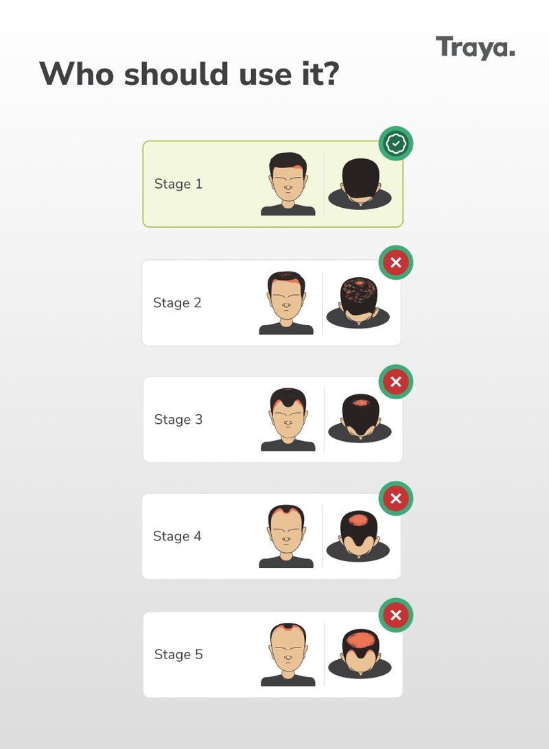 Traya Hair Regrowth Starter Combo Kit for Men | Stage 1 of Hair Loss | Combo of 4 Products - Image 2