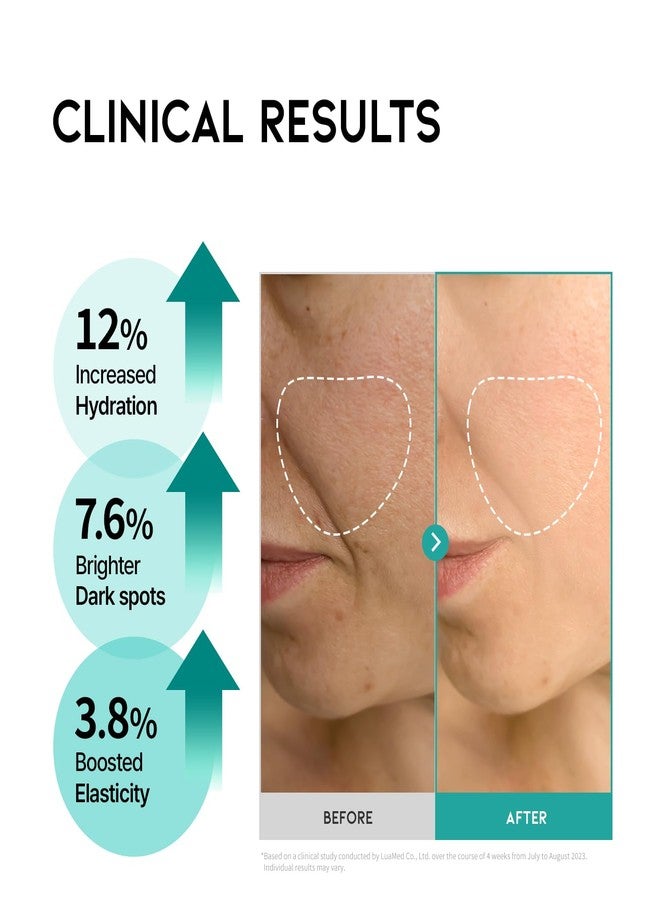 #OOTD OOTD Retinol Serum for face anti aging [1.69 Fl Oz]: Korean Retinol Serum for face, Vitamin A serum, Face Serum for Elasticity, Smoother and hydrating. Wrinkle Lift Retinol Serum, Made in Korea - Image 4