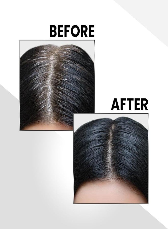 VELEXORI Cover Up Hair Powder Black Instantly Covers Grey Roots Bald Spots Hair Filler for Thinning Hair Long Lasting Matte Finish Natural Look, Easy to Apply Lightweight Formula - Image 2