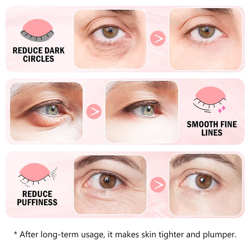 Onespring Under Eye Patches (30 Pairs) - 24K Gold Eye Mask for Puffy Eyes, Dark Circles, Under Eye Bags and Smooth Wrinkles, Eye Gel Pads With Collagen, Hyaluronic Acid & Castor Oil - Image 2