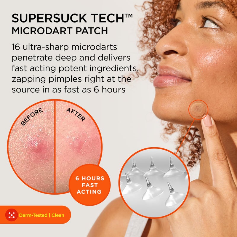 ZitSticka Killa Pimple Patches for Face - World's Most Potent Pimple Patch with Fast-Acting Microdarts - Starts Working within 6 Hours for Deep, Early-Stage Zits - Mini 16 Count - Image 2