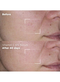 SKIN REPUBLIC Skin Republic Vitamin C Face Serum brightens and even tones 30ml  - Image 5