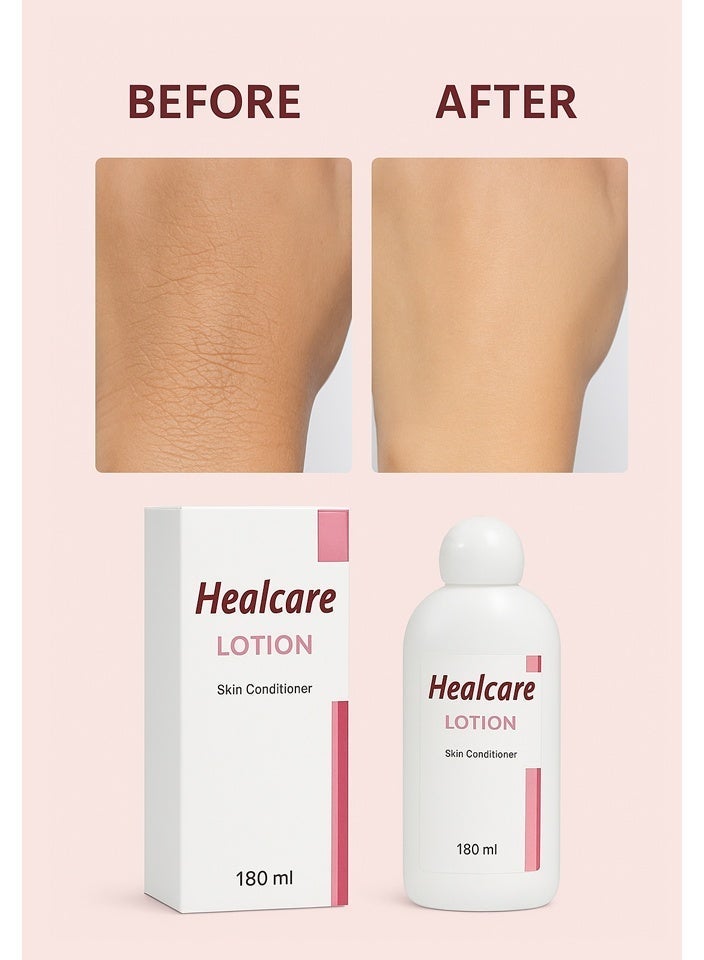 Healcare lotion Skin conditioner for dry cracked & Scaly skin . Urea 180 ml - Image 2