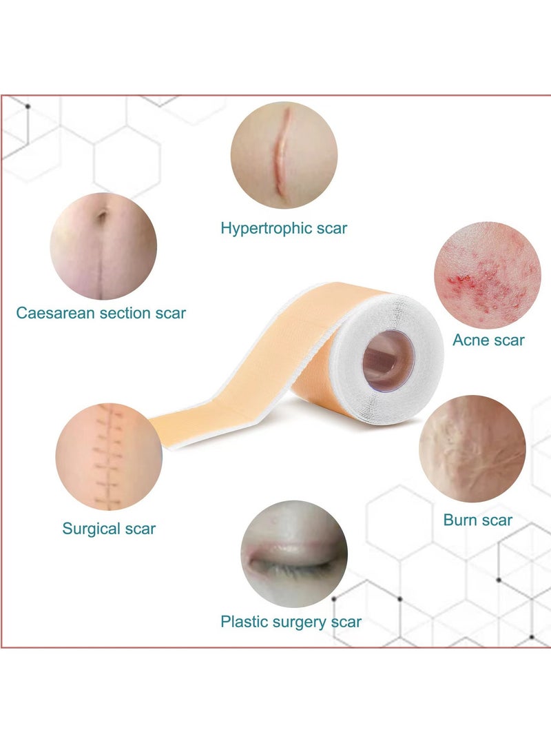EIONN Silicone Scar Sheets, Fade Scar Sticker, 4cm*1.5m, Efficient Beauty Scars Removal Self-adhesive Acne Burn Repair Soft Silicone - Image 5
