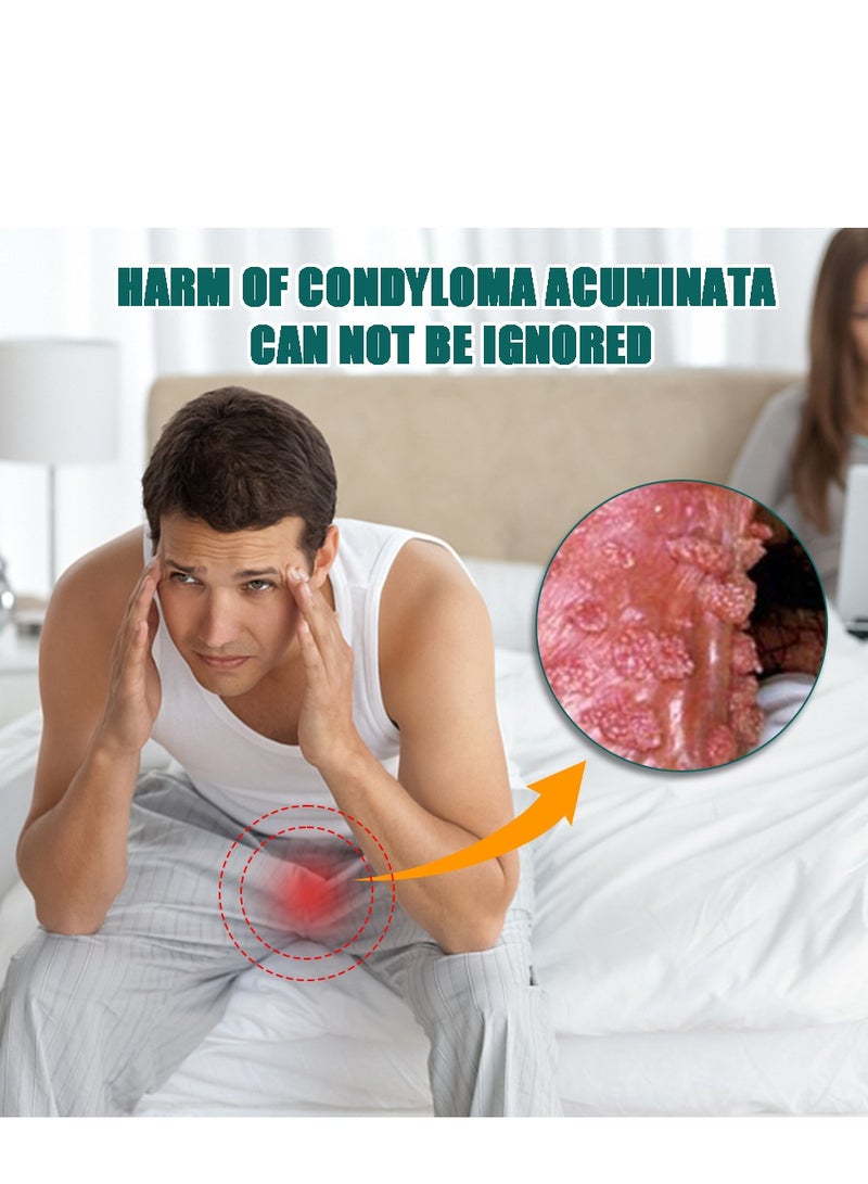 سوميفون كريم إزالة الثآليل، كريم محمول لطيف وآمن لإزالة الثآليل بمستخلصات طبيعية لجميع أنواع البشرة، عالمي لإزالة الثآليل لكل من الرجال والنساء. حماية الصحة والجمال 20 جم - Image 3