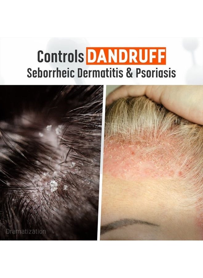 Medicasp - Coal Tar Gel Dandruff Shampoo to Treat Seborrheic Dermatitis Psoriasis, 6 Ounce (Pack of 1) - Image 1