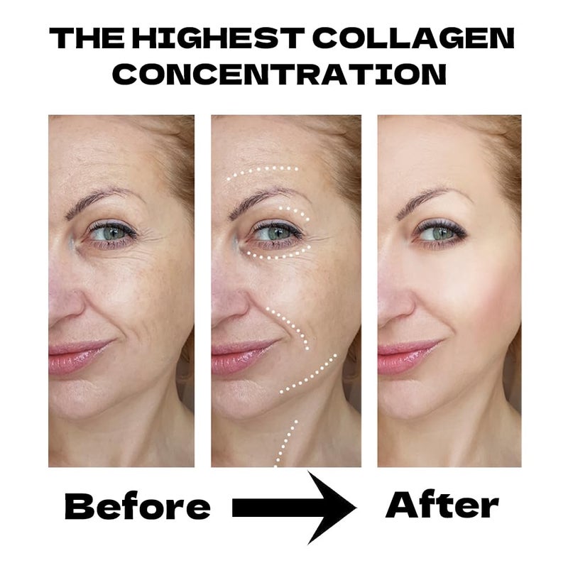 MKBLNP Collagen Face Mask Hydrating Overnight Collagen Face Mask (6 pcs/1 Box) Deep Collagen Anti Wrinkle Lifting Mask - Pure Collagen Films for Improve Elasticity Firming And Moisturizing - Image 3