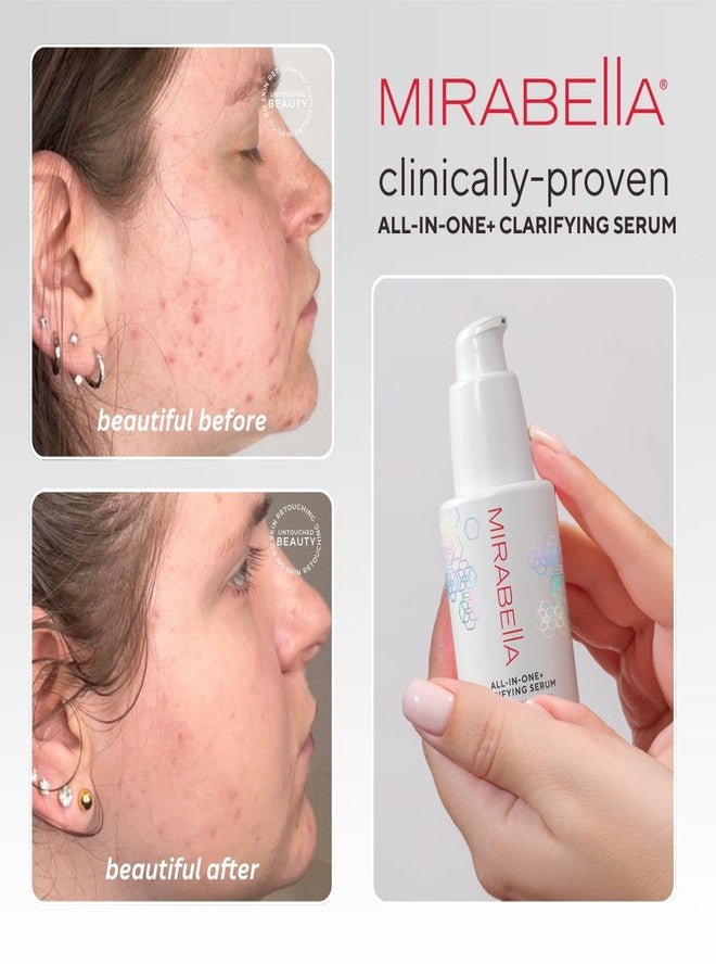 Mirabella All In One Clarifying Serum Micro Peel for Anti Aging - Hydrating 7% Glycolic Acid & 8.8% Lactic Acid Serum Face Peel with AHA BHA Exfoliant, 1 Oz - Image 4