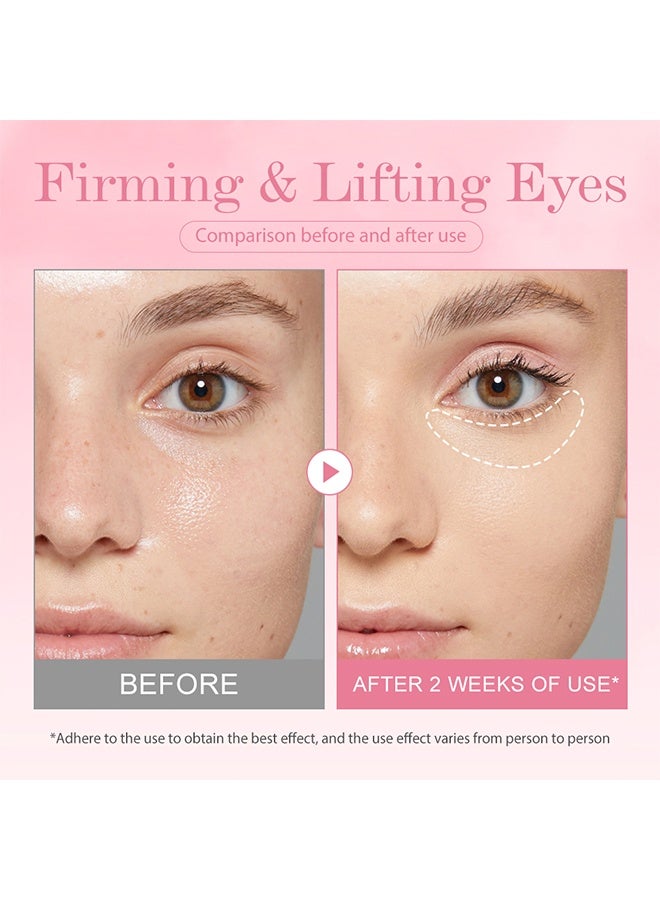 ك أو إي سي جل العين لرفع الهالات السوداء، ريتينول كولاجين ببتيد للتقوية والتعبئة | حمض الهيالورونيك لترطيب متألق | نياسيناميد للهالات السوداء - Image 3