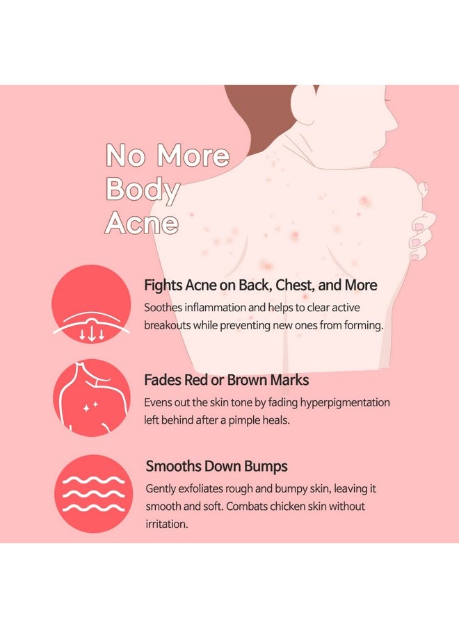 TIAM - Antiblemish Body Lotion Body Acne Treatment Bacne Great For Fighting Breakouts And Acne Scars Removal 6.76 Fl.Oz. - Image 1