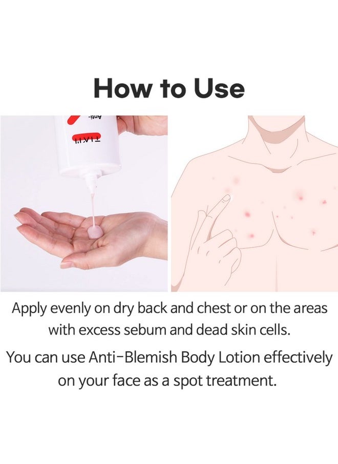 TIAM - Antiblemish Body Lotion Body Acne Treatment Bacne Great For Fighting Breakouts And Acne Scars Removal 6.76 Fl.Oz. - Image 1