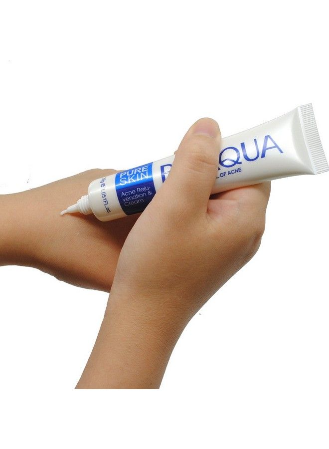 BIOAQUA كريم علاج حب الشباب وإزالة الندبات والبقع على الوجه - Image 4