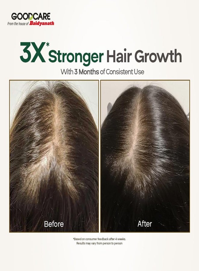 GOOD CARE Goodcare Root Boost Hair Oil 100 ml | Hibiscus & Bhringhraj Blend | 12 Ayurvedic Herbs & Oils | Stronger Roots | Reduced Hair Fall, Stimulates Follicles, Restores Shine & Natural Growth - Image 3