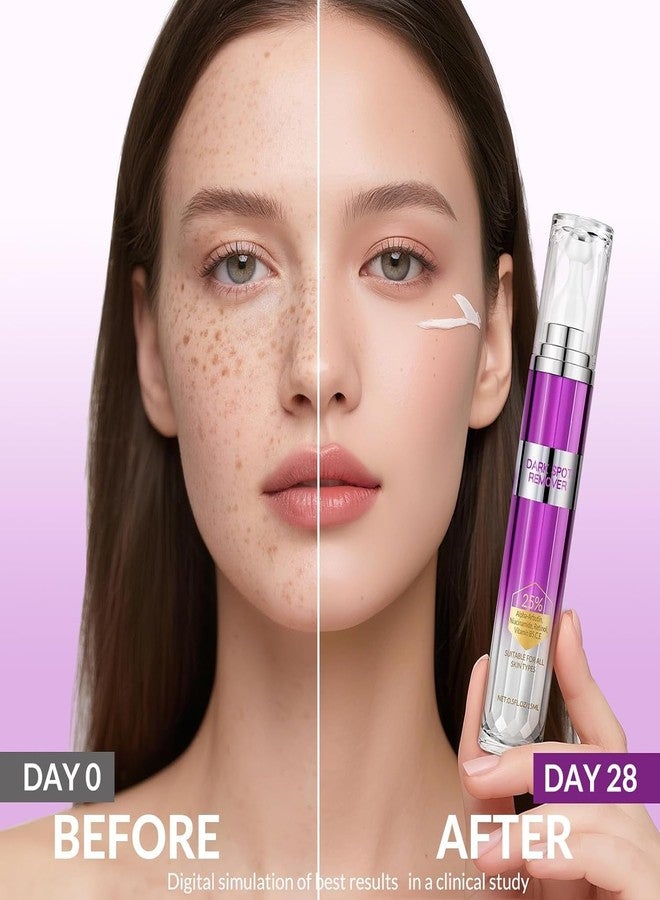 YTDB Dark Spot Remover for Face and Body, Age Spot Sun Spot Freckles Remedy Corrector Serum,Melasma Treatment for Face, Advanced Fade Cream for Uneven Skin Tone with 360° Roller Massage Ball, 0.5 FL oz - Image 5